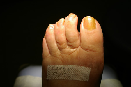 Imatge real post operat�ria